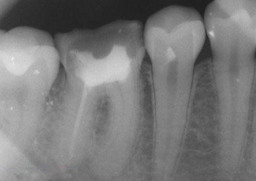 中國再生牙齒研究新進(jìn)展，重塑微笑，科技引領(lǐng)牙齒再生新篇章